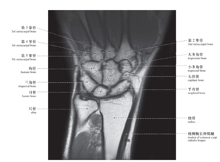 腕和手_人体局部解剖图谱