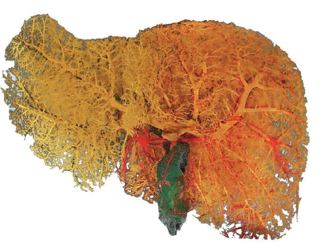 图172 肝脏管道铸型(脏面)cast of the hepatic duct(visceral