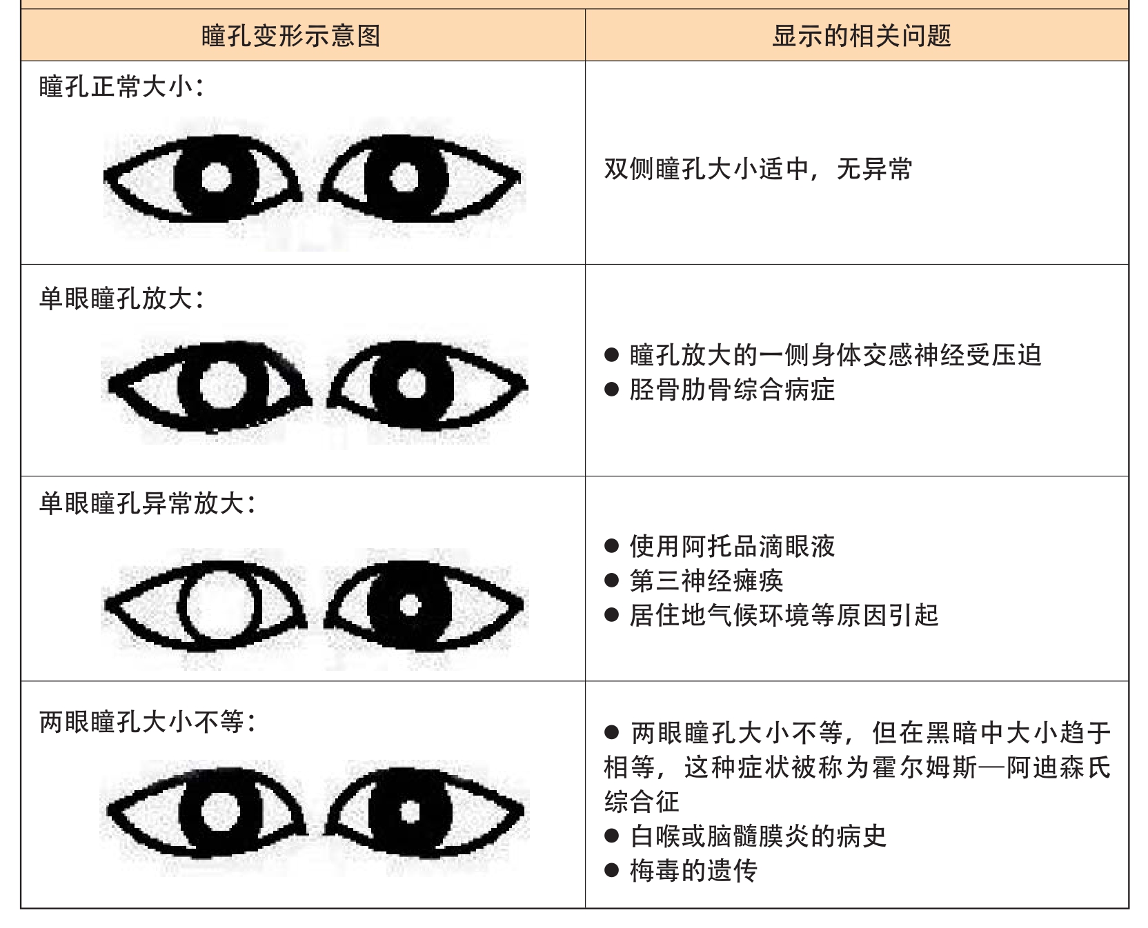 瞳孔放大图片对比,瞳孔扩散和正常瞳孔图,瞳孔放大与正常图像_大山谷图库