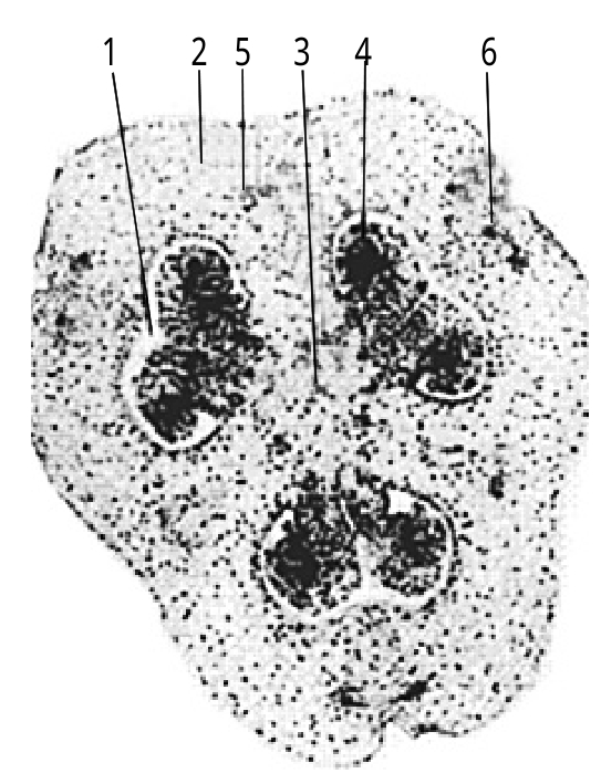 百合胚珠纵切结构图图片