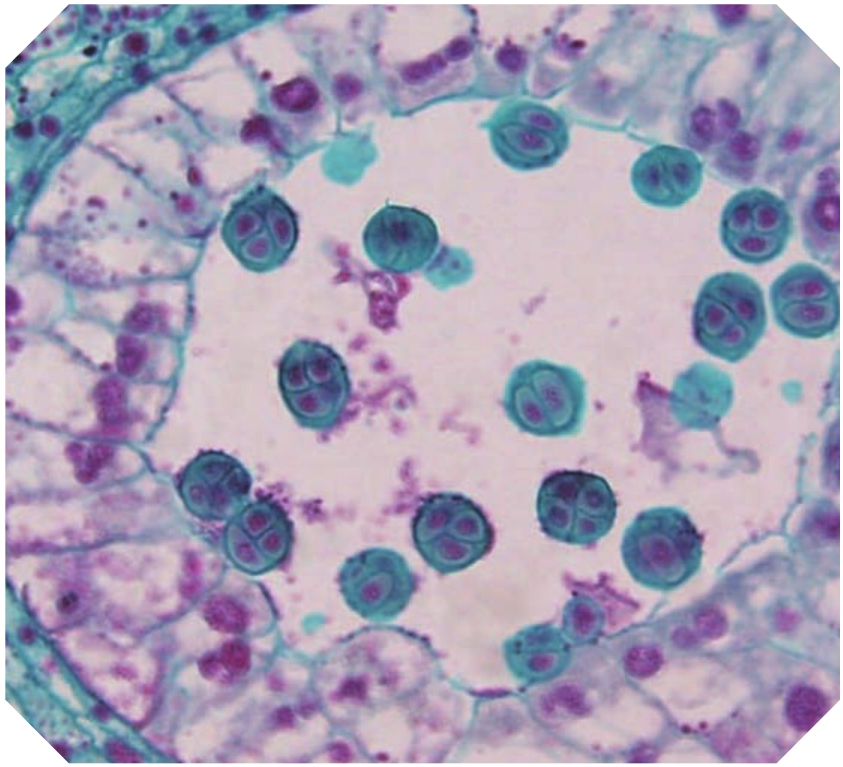 四联球菌形态图图片