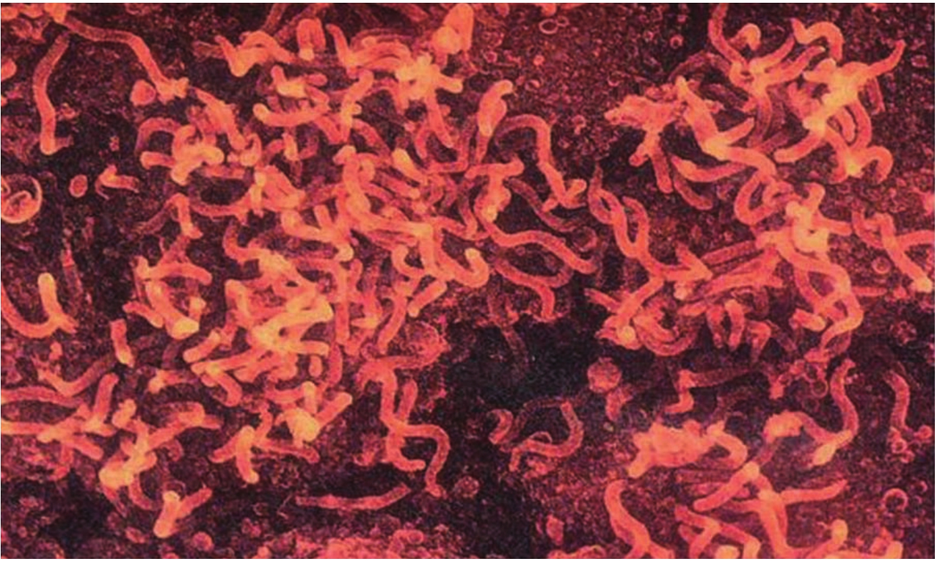 霍乱弧菌镜下图片图片