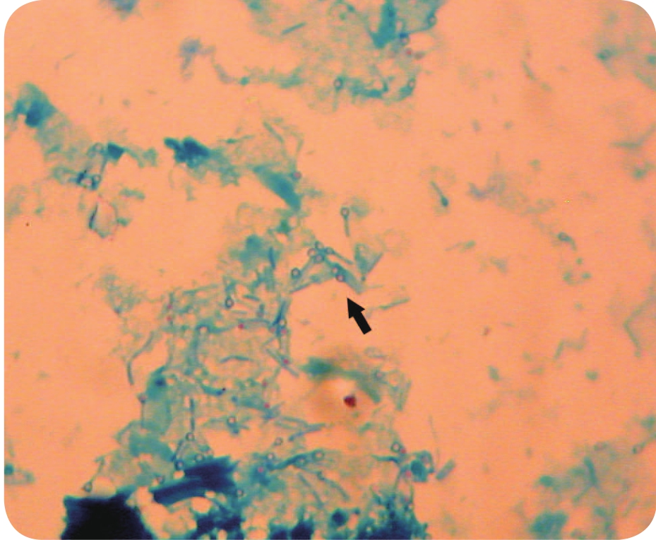 伤寒杆菌显微镜下图片图片