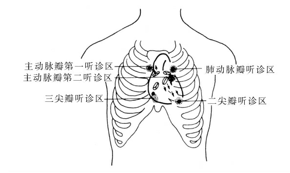 腹部听诊部位示意图图片