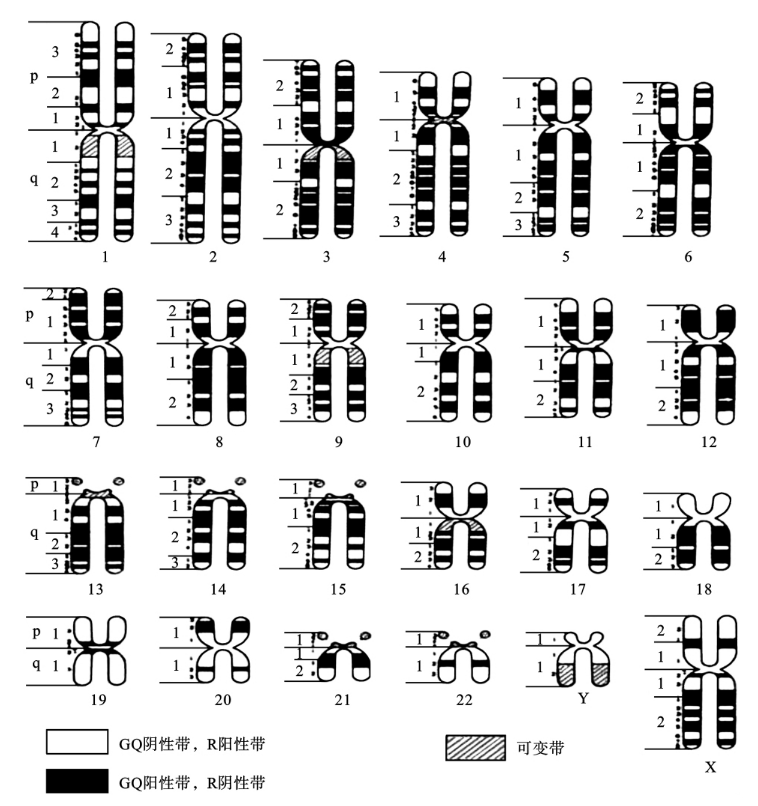 染色体组型 正常图片