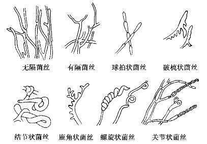 放线菌结构图手绘图图片